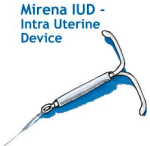 IUD IUD